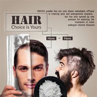 Warum bekomme ich Akne auf meiner Kopfhaut? Experten erklären Akne und Schupp...