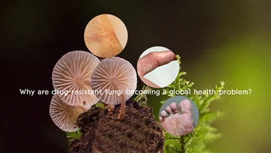 Warum werden arzneimittelresistente Pilze zu einem globalen Gesundheitsproblem?