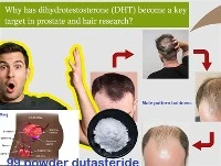 Warum ist DHT zu einem wichtigen Ziel in der Prostata- und Haarforschung gewo...